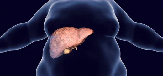 Fatty Liver - Ayurvedic Medicine, Treatment and Remedies