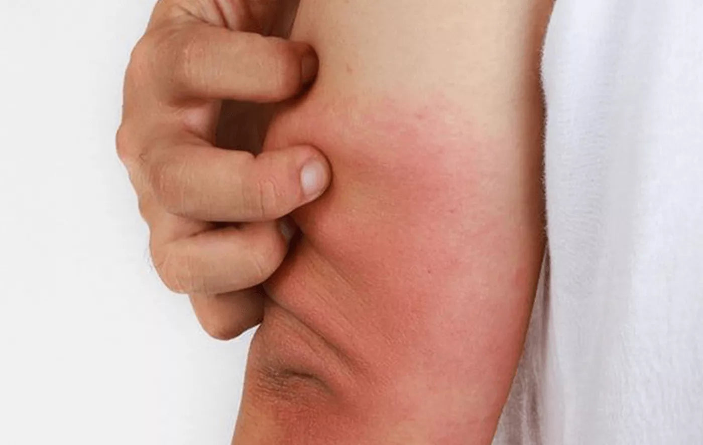 Treat Different Types of Skin Diseases With Ayurveda | Kerala Ayurveda