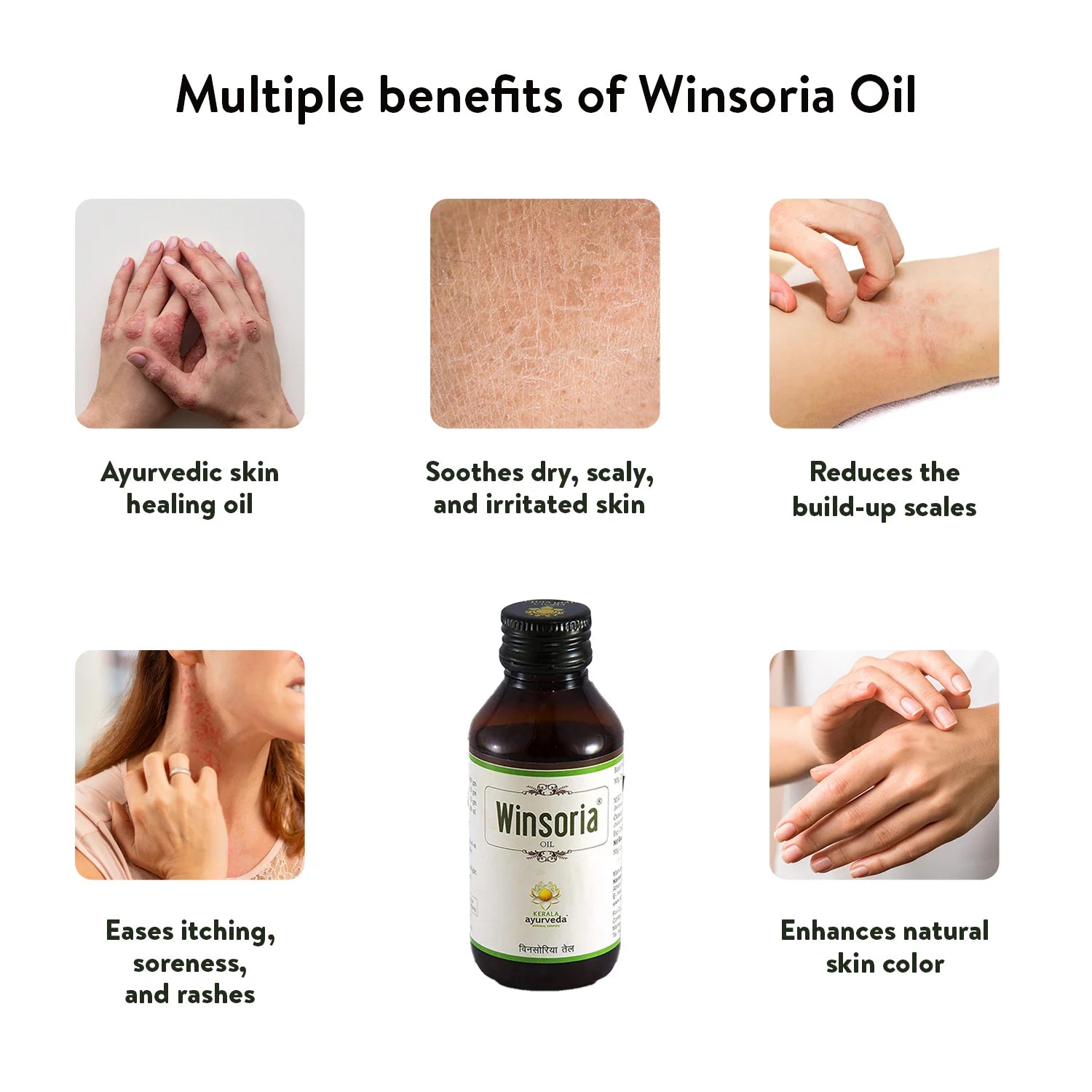Graphic of Winsoria Oil’s multiple benefits: heals skin, soothes dryness, reduces scales, eases itching and enhances natural tone – Kerala Ayurveda India