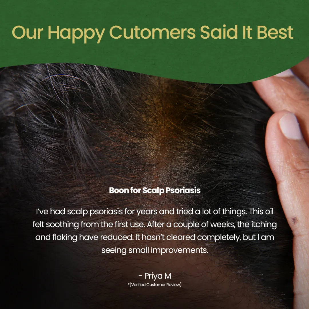 Winsoria Oil (100 Ml)